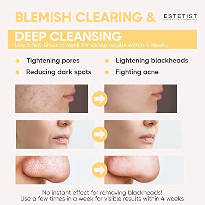Estetist TURMERIC VITAMIN C CLAY FACE MASK STICK SET FOR DARK SPOTS OIL CONTROL AND BALANCE FACIAL MASK DEEP PORE CLEANSER BLACKHEAD REMOVER ANTI-ACNE TREATMENT FOR ALL SKIN TYPES GIFT PACK OF 3 - Image 4